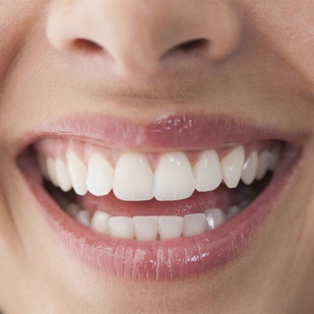 teeth naturally whiten should why guide goodhousekeeping source