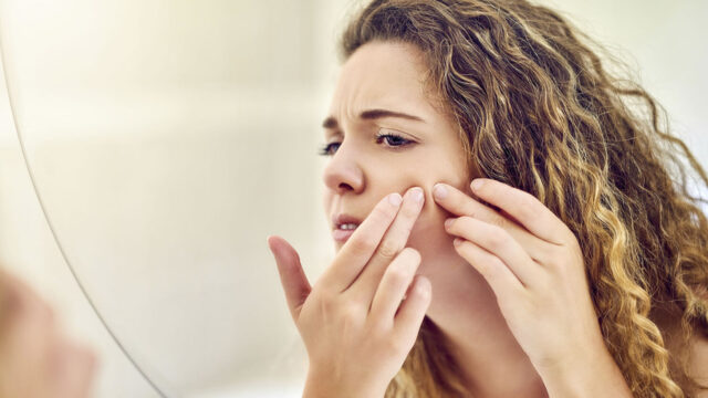 What Is The Difference Between Bacterial And Hormonal Acne? - Health ...