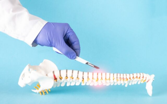 Spinal stenosis