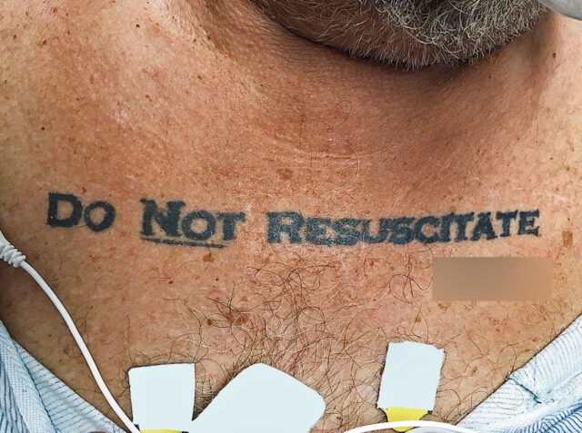 what is a Do Not Resuscitate order