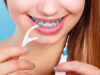 How To Floss Properly With Braces