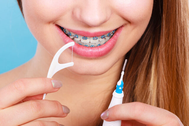 How To Floss Properly With Braces