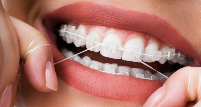 Flossing Using Dental Tape